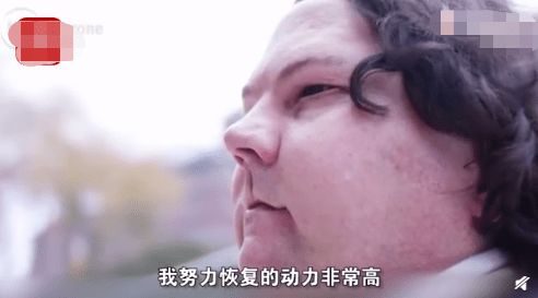 全球首例成功换脸换手男子将结婚，重生与爱的绽放